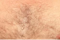 Photo Textures of Human Skin